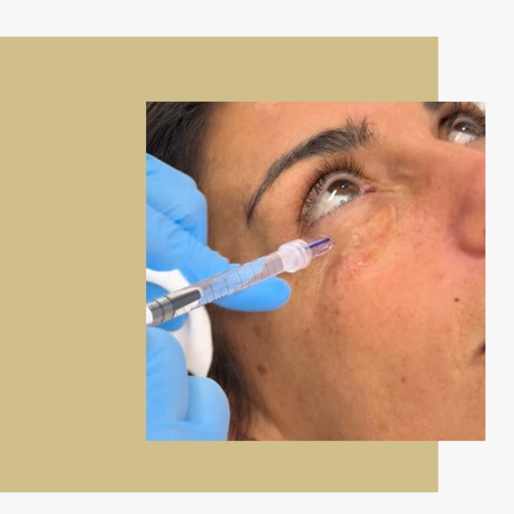 O que é o Microagulhamento ou Microneedling